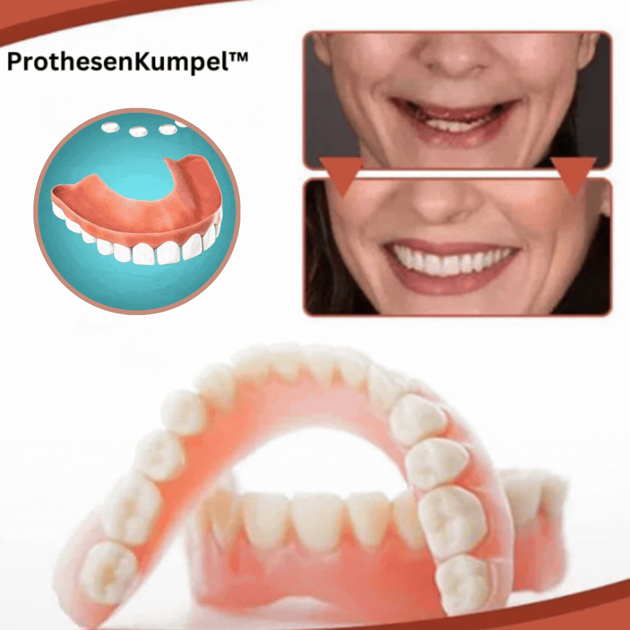 Biocompatible  Prosthesis Set for Pain-Free Fit and Natural Smile