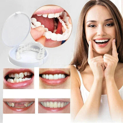 Snap-On Veneers Set for Upper &amp; Lower Teeth with Custom Fit | Removable Solution for a Natural-Looking Smile