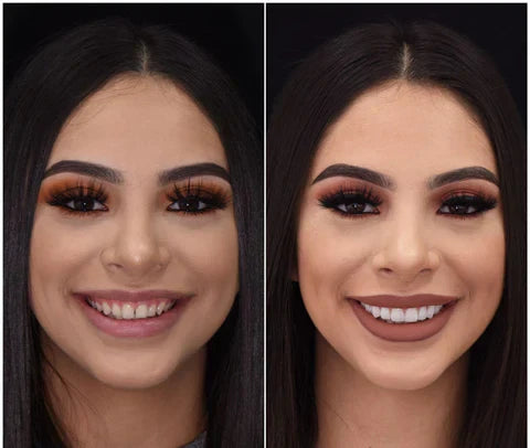 Snap-On Veneers Set for Upper &amp; Lower Teeth with Custom Fit | Removable Solution for a Natural-Looking Smile